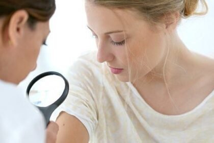 dermatology mission Viejo CA