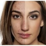 dermatologist Costa Mesa CA