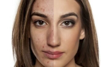 dermatologist Costa Mesa CA