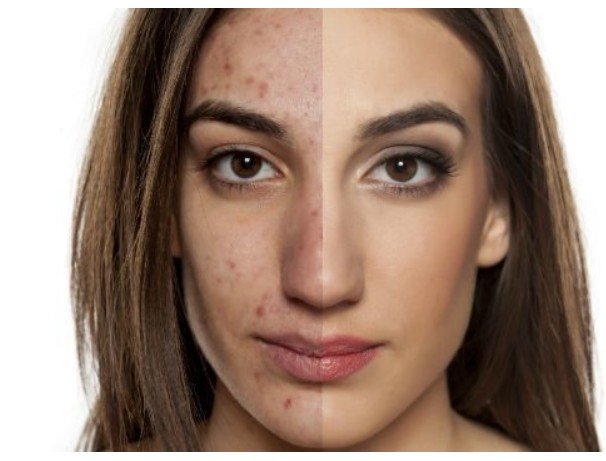 melanoma treatment irvine ca